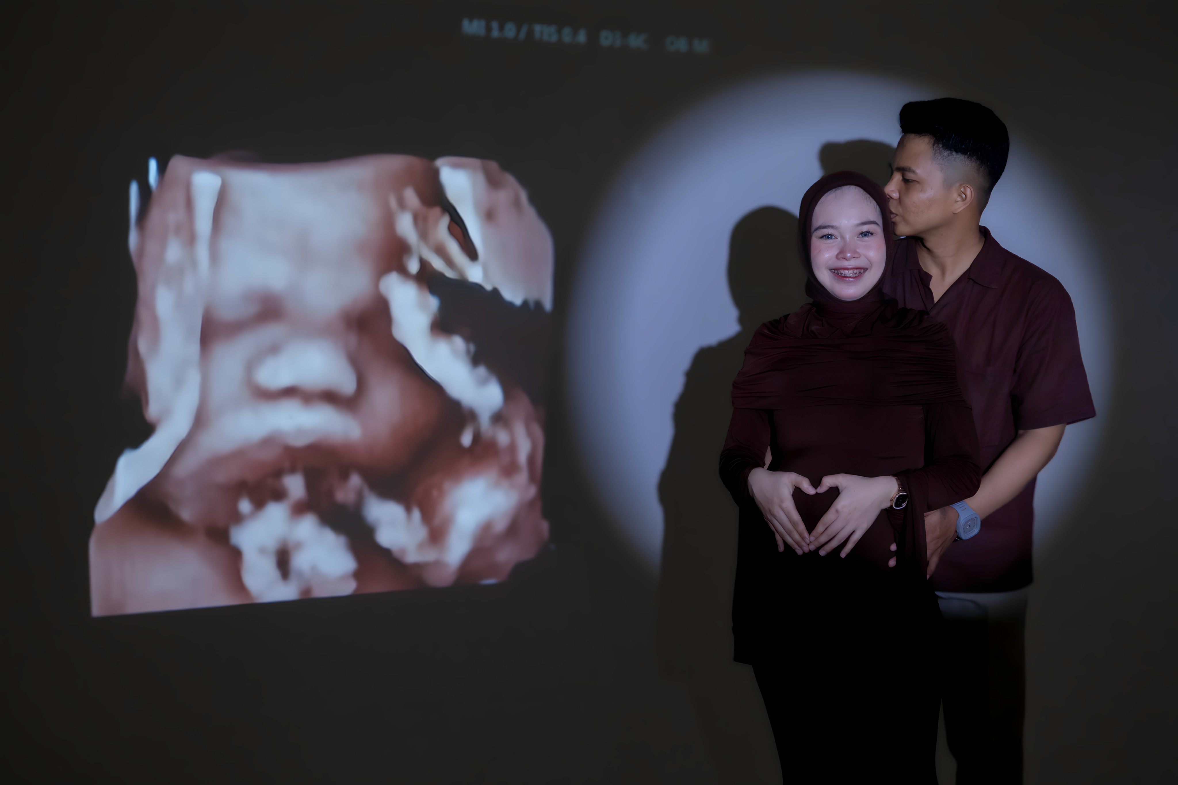 Maternity