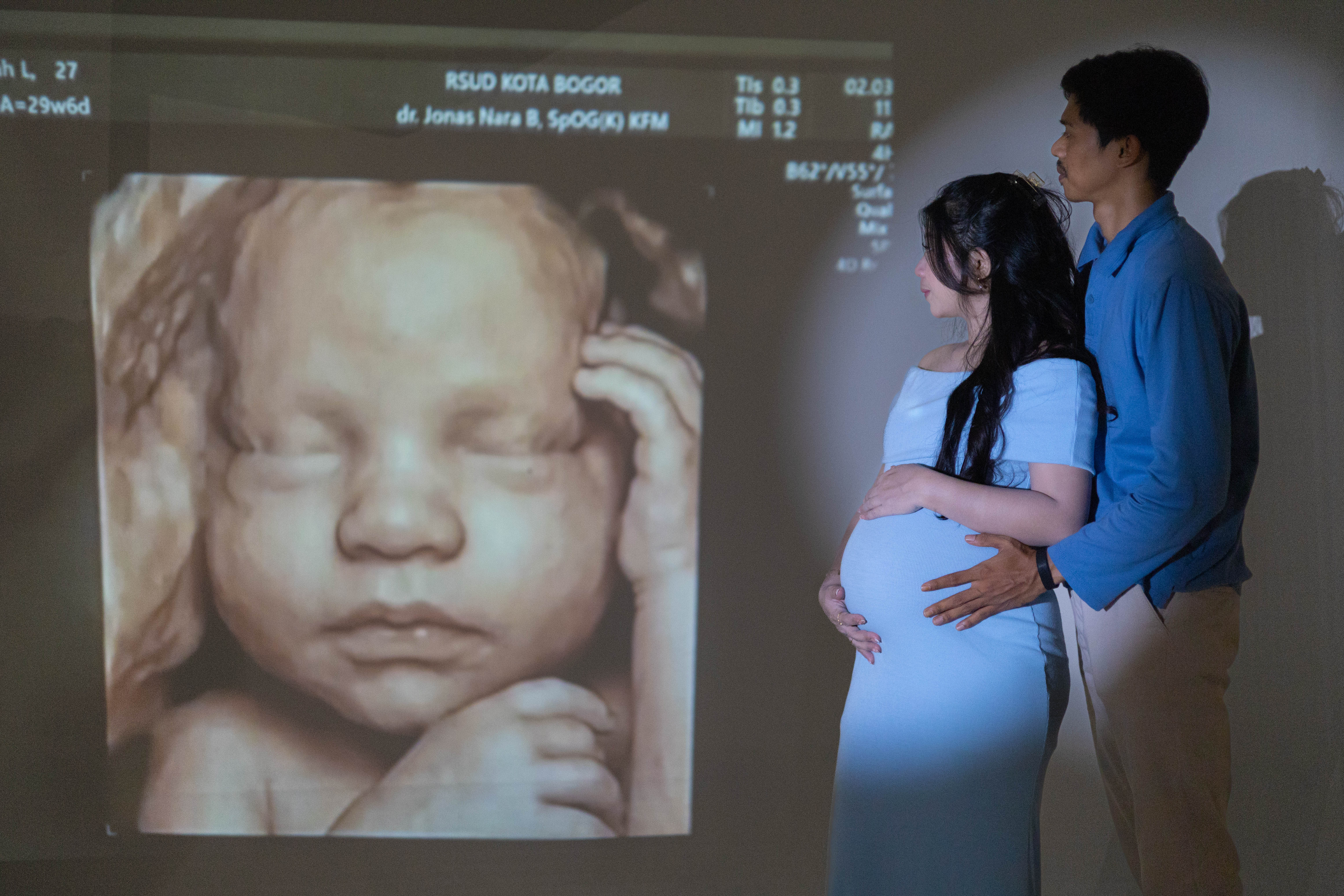 Maternity